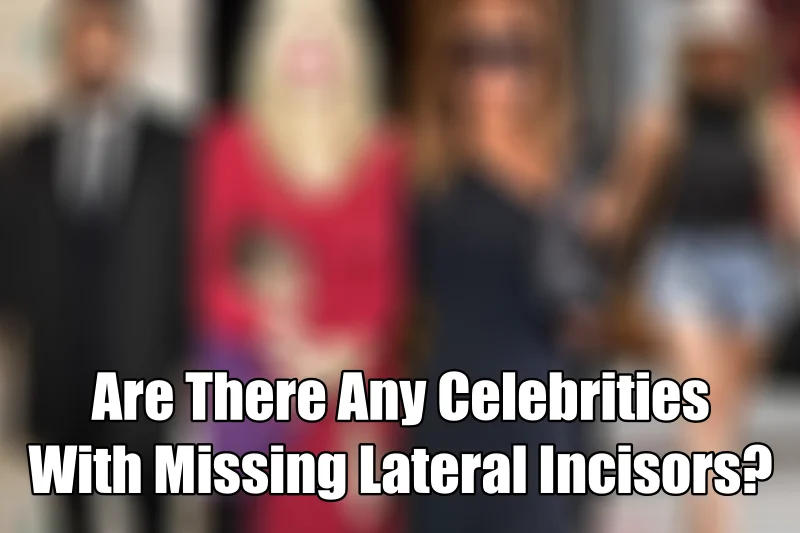 Celebrities With Missing Lateral Incisors